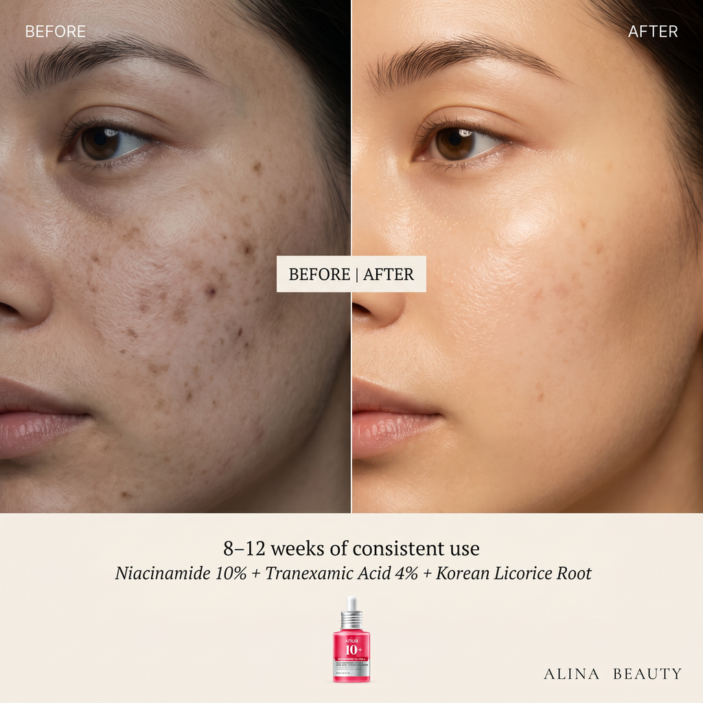 Anua Niacinamide 10% + TXA 4% Dark Spot Correcting Serum