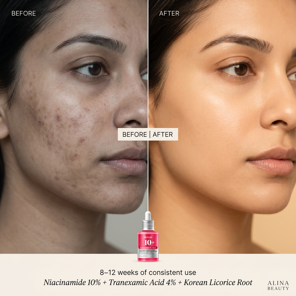 Anua Niacinamide 10% + TXA 4% Dark Spot Correcting Serum
