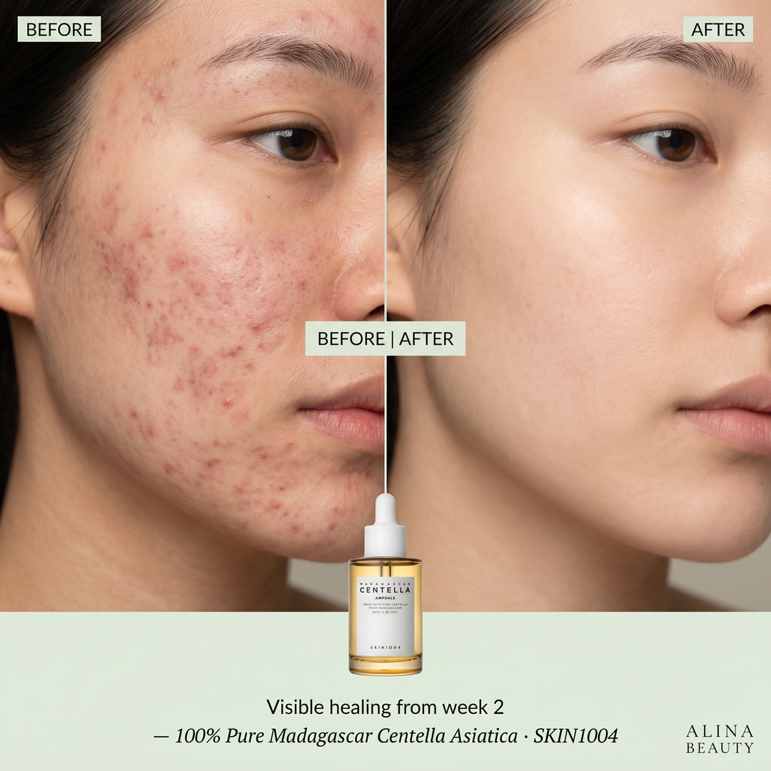 Skin1004 Madagascar Centella Ampoule