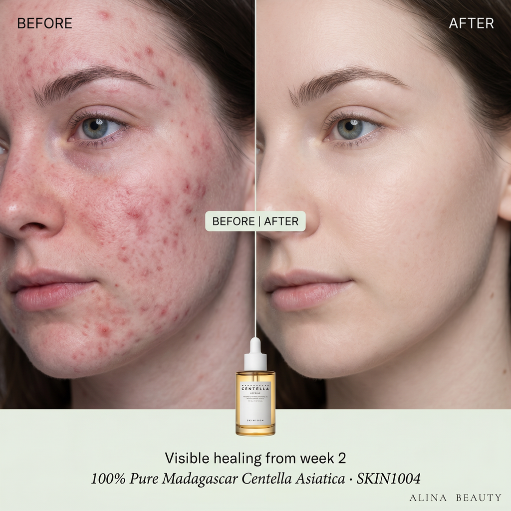 Skin1004 Madagascar Centella Ampoule
