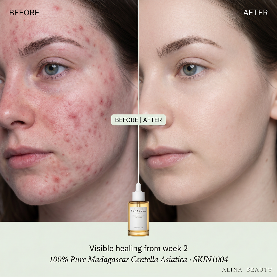 Skin1004 Madagascar Centella Ampoule
