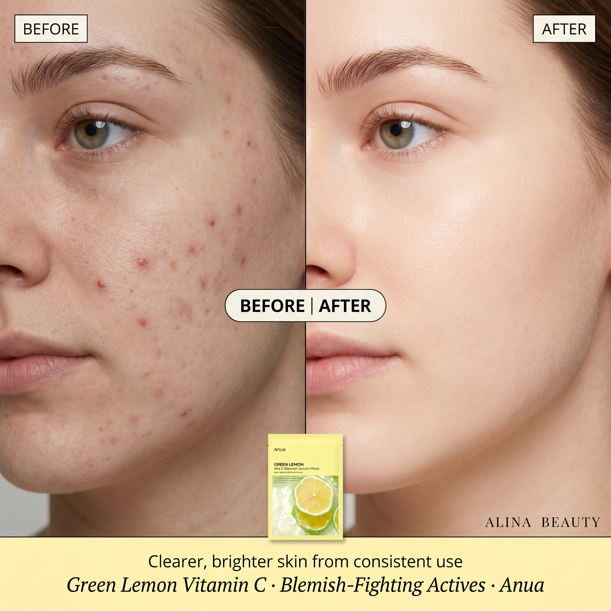 Anua Green Lemon Vita C Blemish Serum Mask 25ml