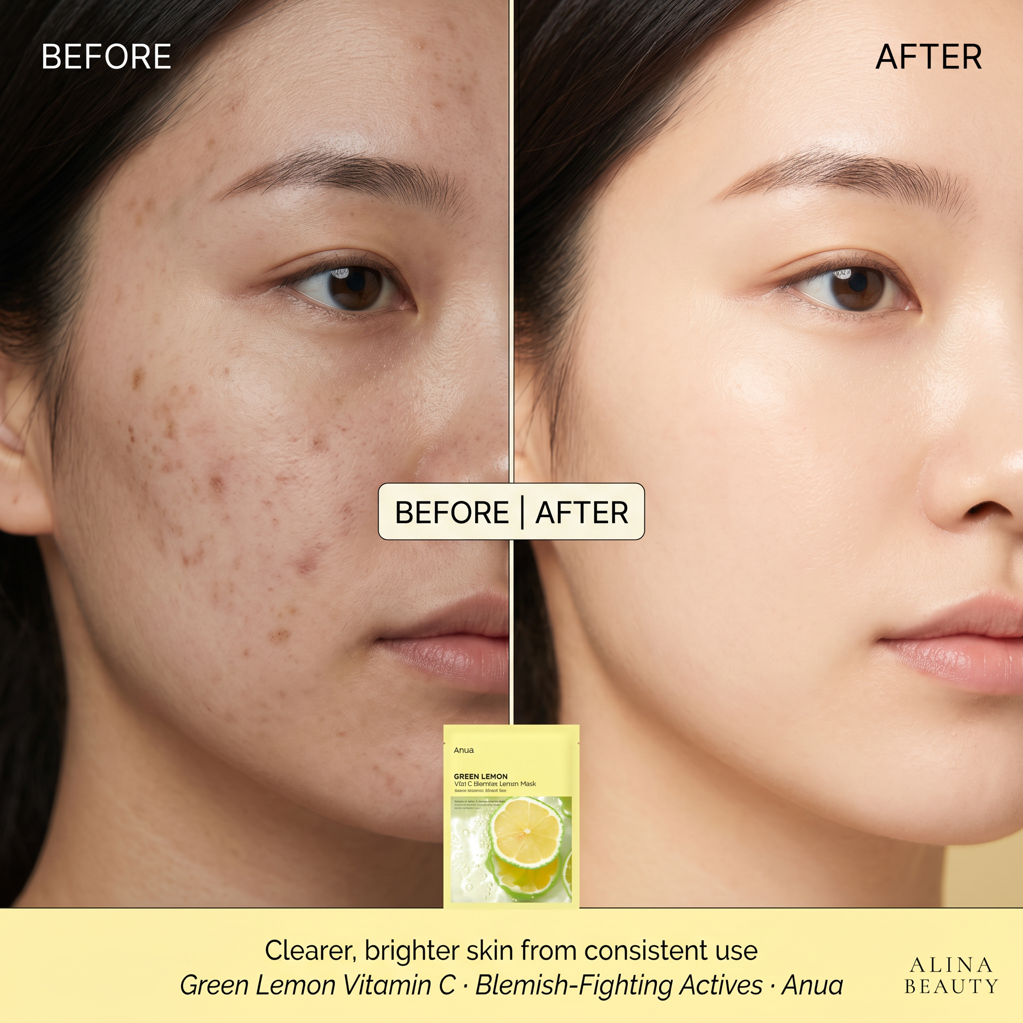Anua Green Lemon Vita C Blemish Serum Mask 25ml